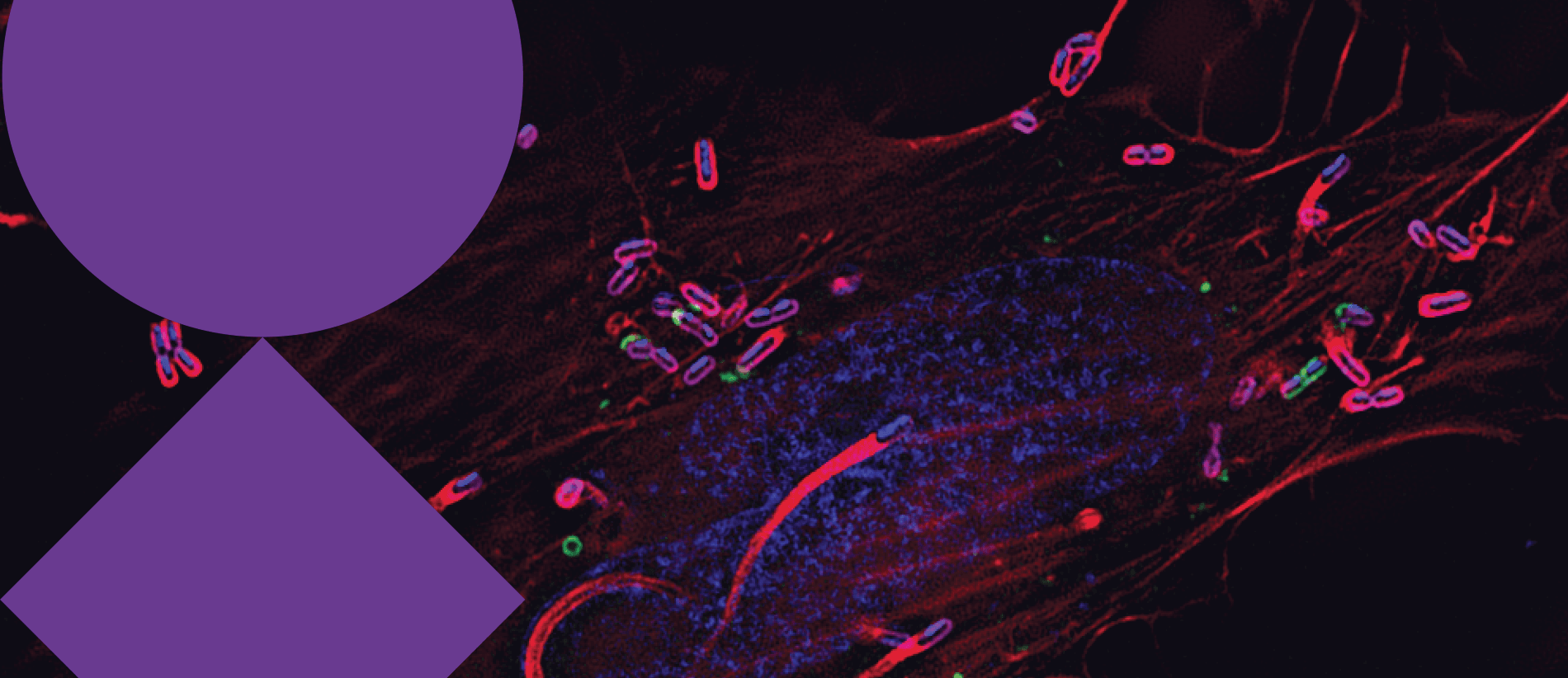 Next-generation mRNA vaccines against complex pathogens: From antigen selection to clinical translation