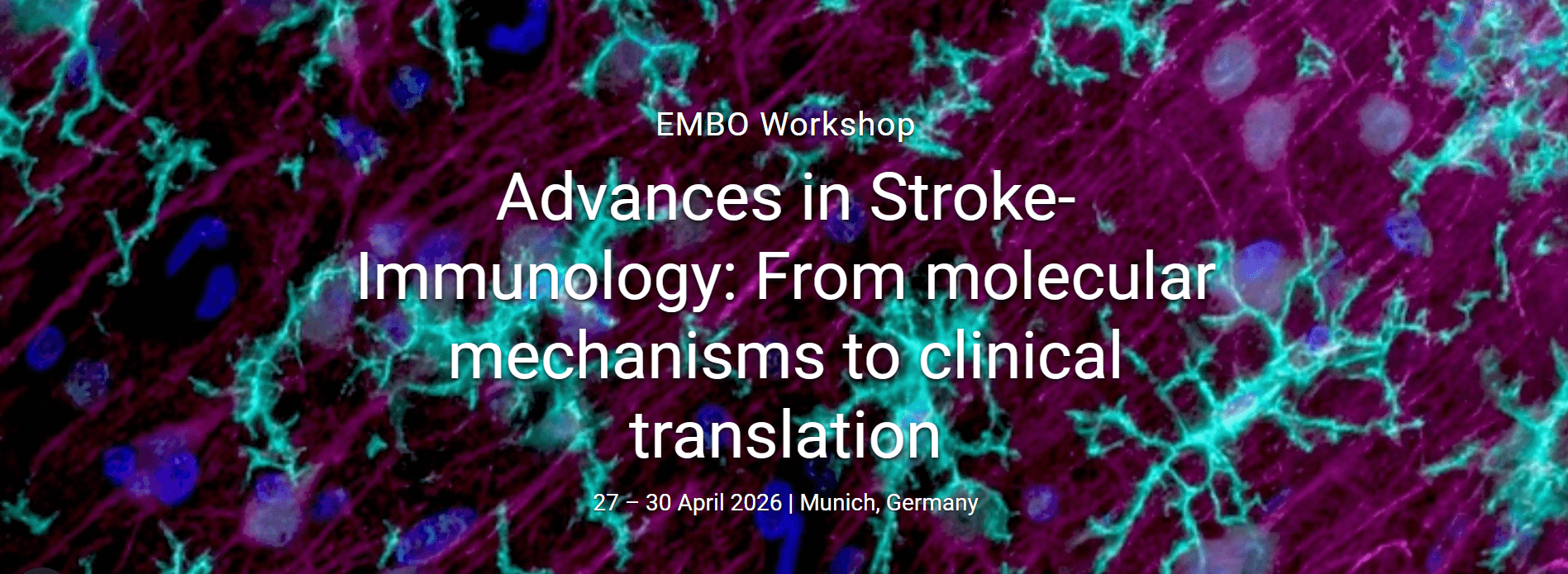 Advances in Stroke-Immunology: From molecular mechanisms to clinical translation